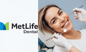 MetLife Dental - What It Is & Available Products