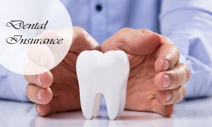 Dental Insurance: What It Is and How It Works