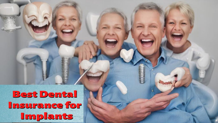 Best Dental Insurance for Implants of 2024