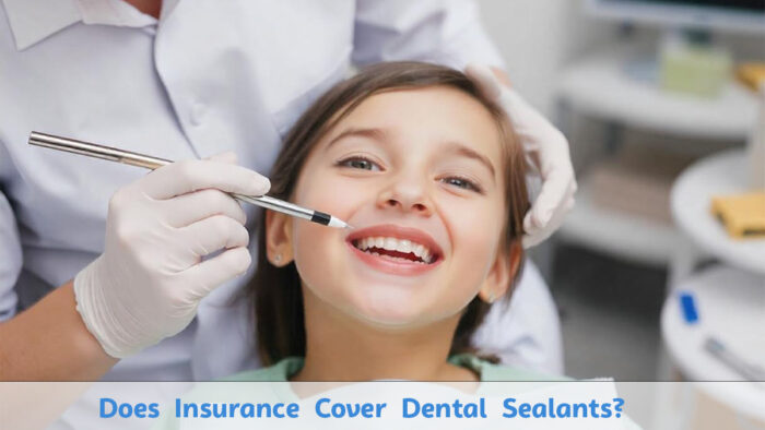 Does Insurance Cover Dental Sealants?